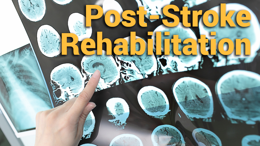 Stroke Rehabilitation